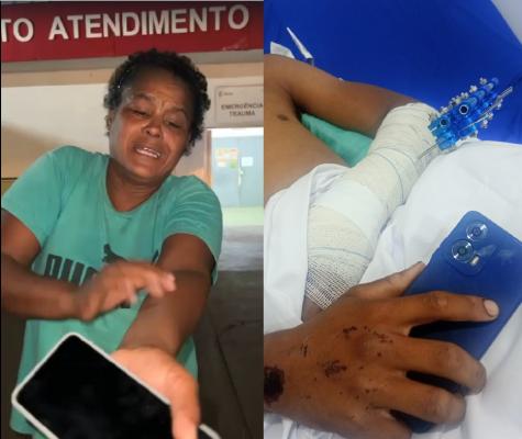 Adolescente internado encontra larvas em ferimento após acidente
